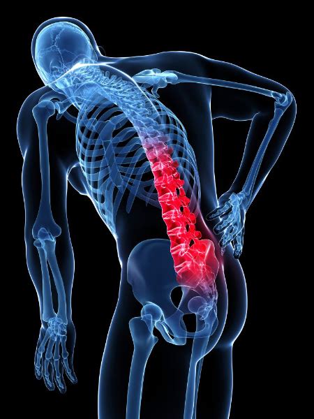 What is Back Pain? Types, Symptoms, Causes, Diagnosis and Treatments