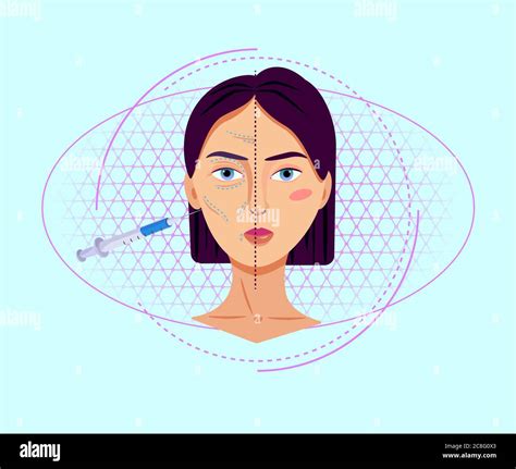 Ilustración De Inyecciones De Colágeno Antiaging Procedimientos De Mesoterapia Para Eliminar