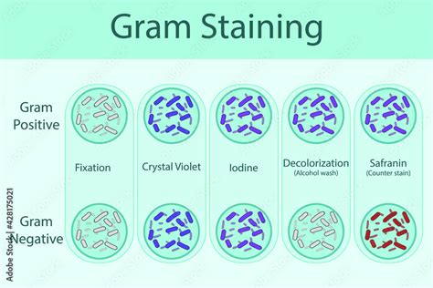 Diagram Showing Gram Staining Technique Steps Microbiology Labolatory