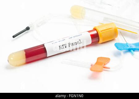 Hiv Blood Analysis Collection Tube Selected By Lab Technician Labels