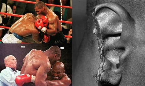 Gruesome Sports Injuries That Will Shock You Disturbing Pics