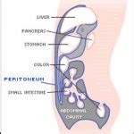 Mesothelioma Cancer Blog Mesothelioma Caner Treatment Of Mesothelioma