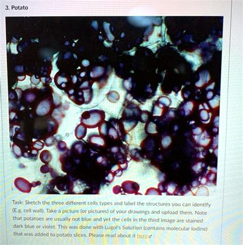 Potato Cell Structure