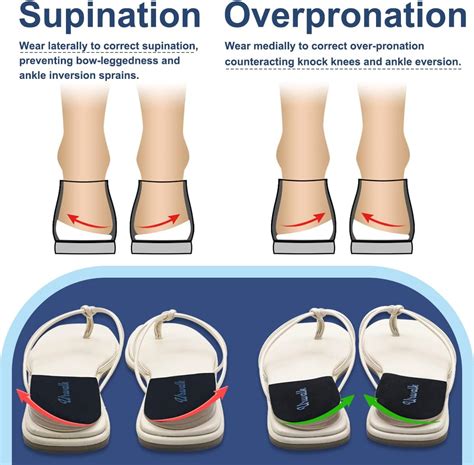 3 capas de Supinación ajustable y sobre Pronación Adhesivo Correctivo