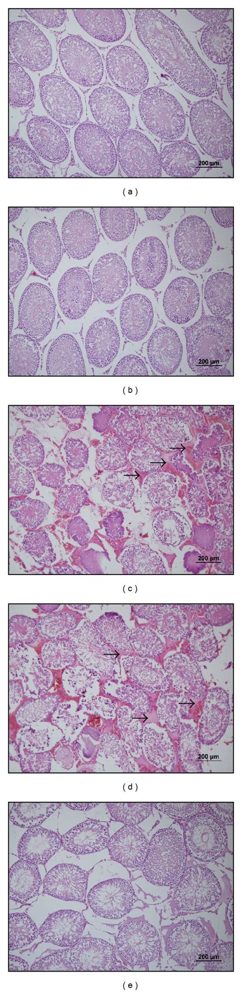 Representative Photomicrographs Of H E Stained Sections Of The Testis