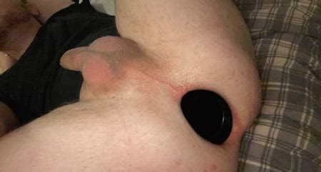 XXL MEO Anal Stretching Ring Pics XHamster