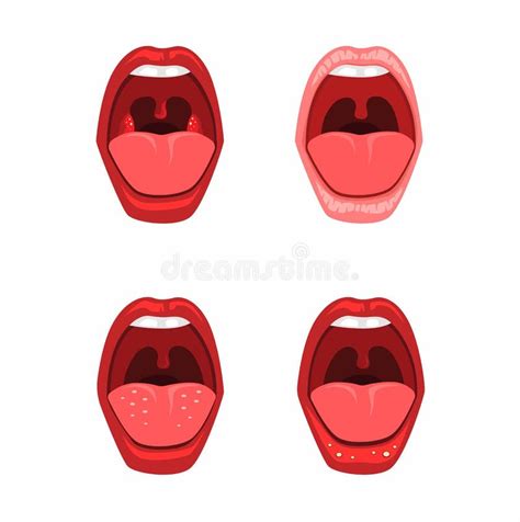 Mouth Lips With Tongue Healthy And Disease Ulcer Stomatitis Symbol Dental Clinic Health Concept