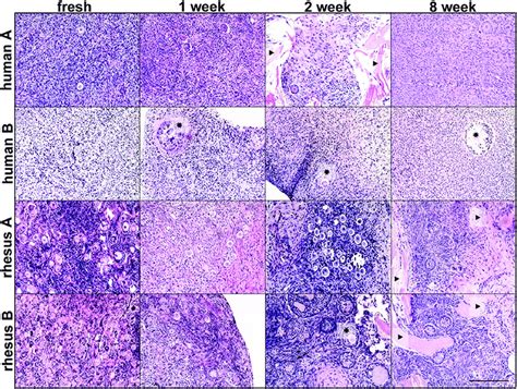 Histological Analysis Of Rhesus Macaque And Human Ovarian Cortical