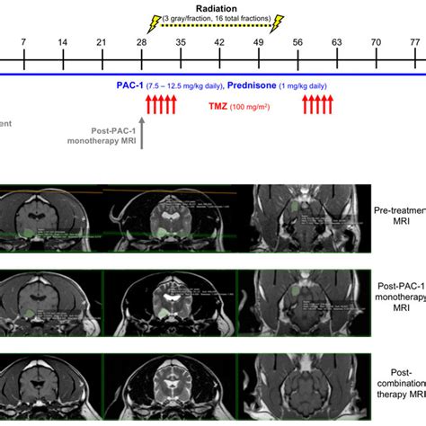 Evaluation Of Combining Oral Pac With Tmz And Definitive Ionizing