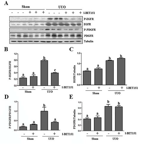 I Bet151 Inhibits Phosphorylation Of Egfr And Pdgfrβ In Obstructed