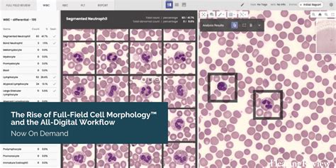 The Rise Of Full Field Cell Morphology™ And The All Digital Workflow