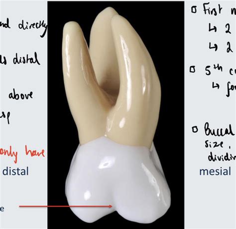 R Maxillary First Permanent Molar Flashcards Quizlet