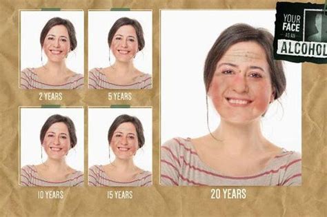 D Couvrez L Effet De L Alcoolisme Sur Votre Visage