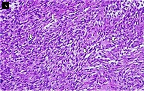 A Microscopic Features Show Round To Spindle Shape Cells White