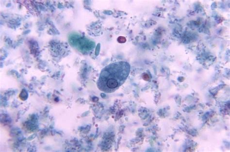 Details Public Health Image Library Phil Health Images Entamoeba Histolytica Public Health