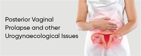 Posterior Vaginal Prolapse And Other Urogynaecological Issues Gauri Urogynecology Clinic