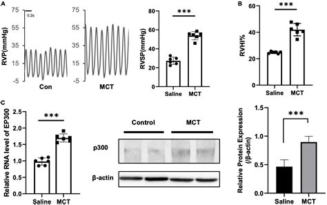 Frontiers The Protective Role Of Ep In Monocrotaline Induced