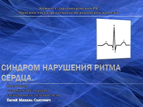 Синдром нарушения ритма сердца - презентация онлайн