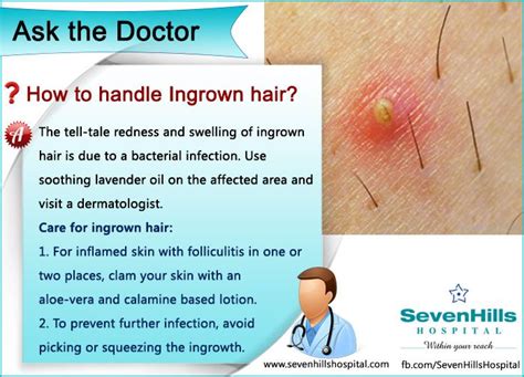 How To Handle Ingrown Hair Ingrownhair Swellingofingrownhair Bacterialinfection Ingrown