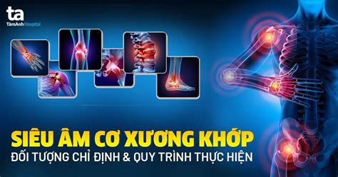 Siêu âm khớp Đối tượng chỉ định và quy trình thực hiện