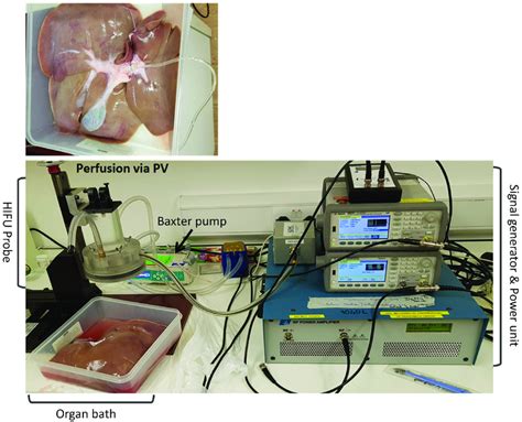 Experimental Set Up For HIFU Probe And Histotripsy Protocol Retrieved