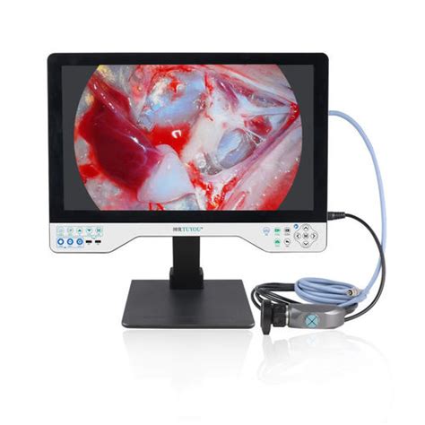 Endoscope Camera TU 24LSD101B Shenzhen Tuyou Medical Imaging