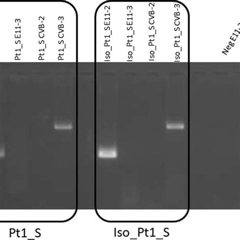 Rt Pcr Performed With Specific Sets Of Primers For E 11 And Cv B On