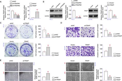 TRAIP Promoted Proliferation Invasion And Migration Of PCa Cells A