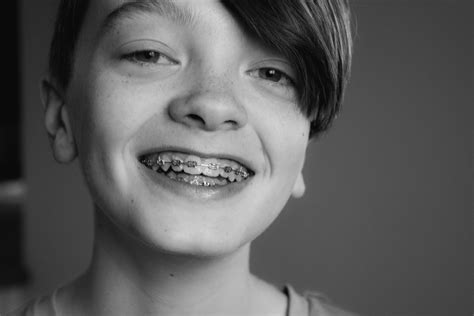 Orthodontist in Arlington, VA - Braces & Invisalign Arlington, VA 22203 ...