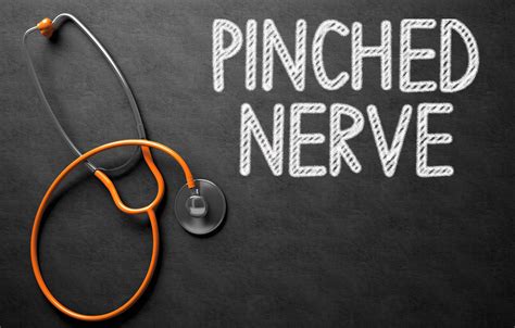 How To Treat Pinched Nerves