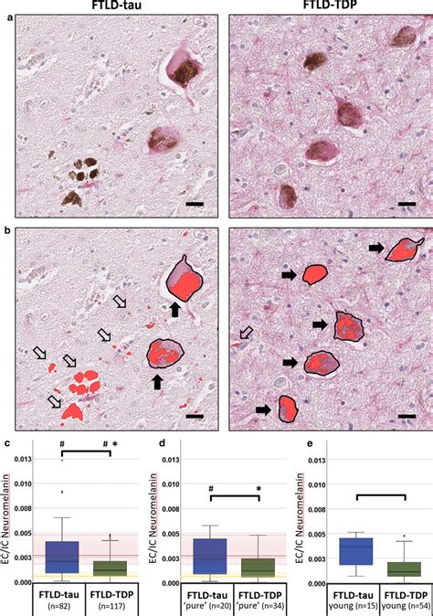 Neuromelanin Content In The Locus Coeruleus Indicates Greater