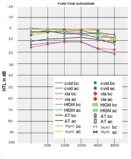 Mean Bone And Air Conduction Threshold Among 55 Patients With Primary Download Scientific