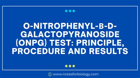 Bile Solubility Test Principle Procedure And Result