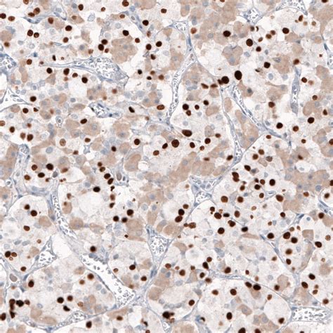 Mouse Monoclonal Anti Tbx Antibody Buy For Research Highly