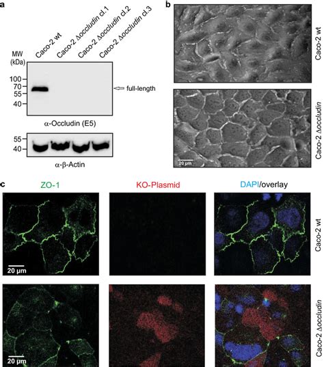 Crispr Cas Knockout Of Occludin In Caco Cells Reveals Partial