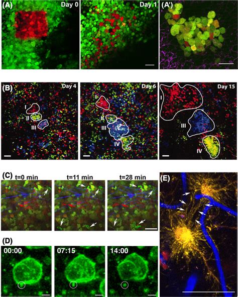 High Resolution Intravital Multiphoton Microscopy IV MPM And New