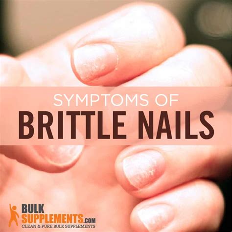 Brittle Nails Symptoms Causes And Treatment