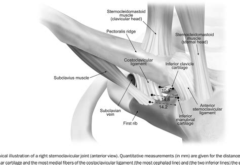 Figure 4 From Surgical Anatomy Of The Sternoclavicular Joint A