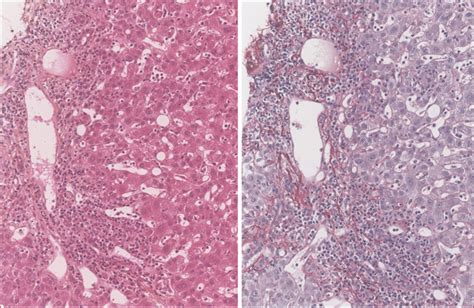 JLE Hépato Gastro Oncologie Digestive Quelle est la prise en