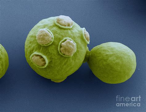 Saccharomyces Cerevisiae Electron Microscope