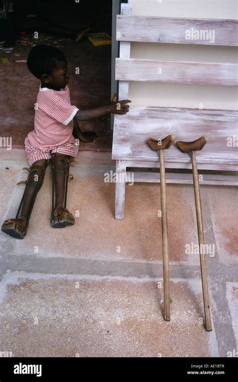 Polio Braces Hi Res Stock Photography And Images Alamy