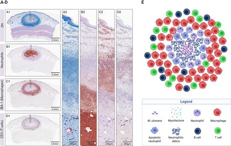 Frontiers Buruli Ulcer The Efficacy Of Innate Immune Defense May Be