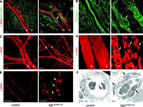 Integrin Subunit Controls Mural Cell Adhesion Spreading And Blood