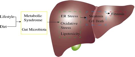 Nutraceutical Approaches To Non Alcoholic Fatty Liver 55 Off