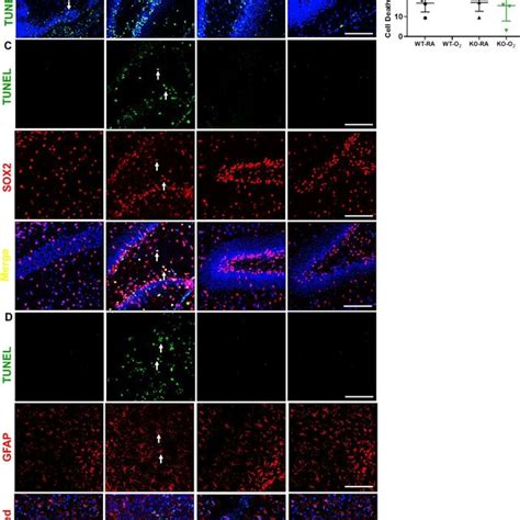 gsdmd expression   brains    study groups  gsdmd