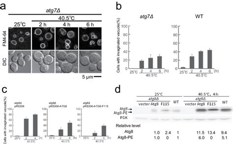 Lipidation Independent Function Of Atg For Suppressing Vacuole