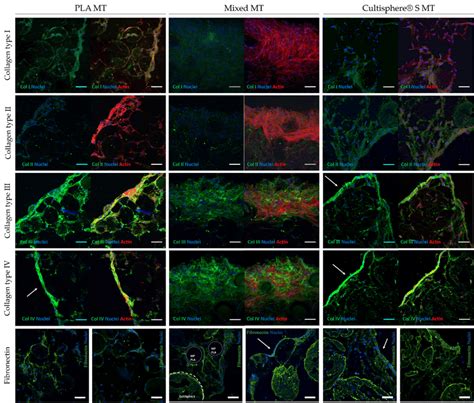 Immunofluorescence Staining Of Sliced Mts For Collagen Types I Ii