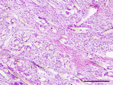 The peripheral area of the lesion was granuloma tissue. There were... | Download Scientific Diagram