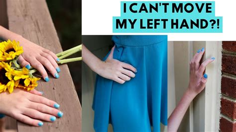 What Its Like Living With Arm Paralysis How My Disability Affects