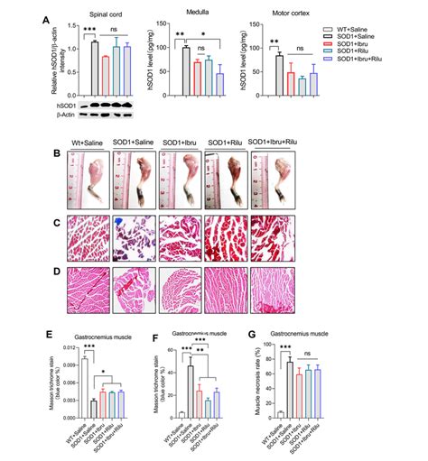 Ibrutinib Rescued Muscle Atrophy In Sod Mice A Representative